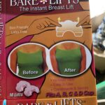 Breast lift
